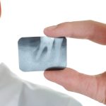 LANAP Laser Treatment